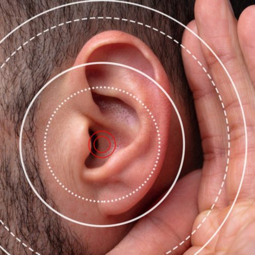 Hearing Loss