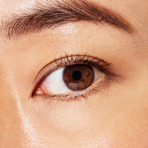 Double Eyelid Surgery