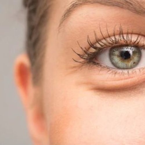 Eyebag Surgery