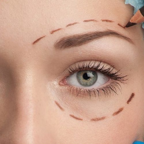 Eyelid Rejuvenation