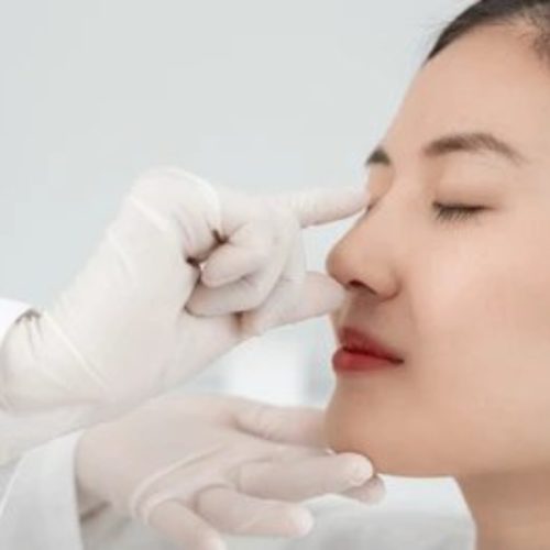 Rhinoplasty