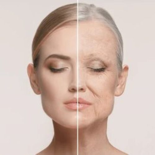 Facelift